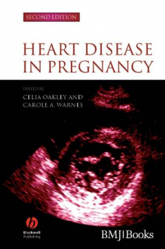 Книга Heart Disease in Pregnancy на ReadRate.com книга Heart Disease in Pregnancy