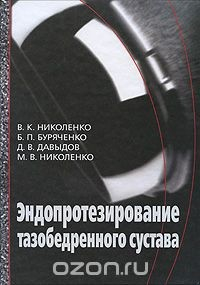 Книга Эндопротезирование тазобедренного сустава на ReadRate.com книга Эндопротезирование тазобедренного сустава