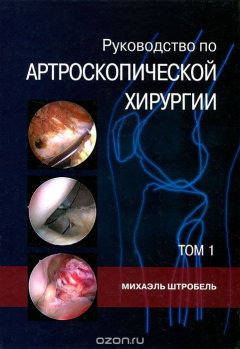Книга Руководство по артроскопической хирургии. В 2 томах. Том 1 на ReadRate.com книга Руководство по артроскопической хирургии. В 2 томах. Том 1