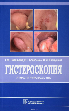 Книга Гистероскопия. Атлас и руководство на ReadRate.com книга Гистероскопия. Атлас и руководство