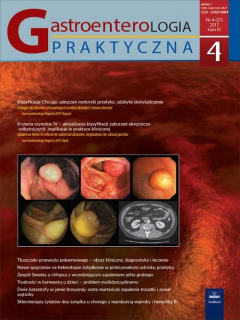 Книга Gastroenterologia Praktyczna 4/2017 на ReadRate.com книга Gastroenterologia Praktyczna 4/2017