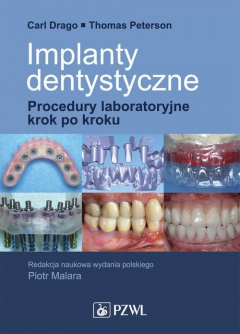 Книга Implanty dentystyczne. Procedury laboratoryjne krok po kroku на ReadRate.com книга Implanty dentystyczne. Procedury laboratoryjne krok po kroku