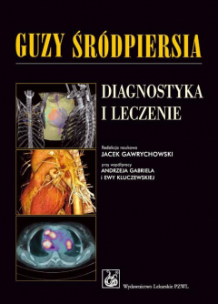 Книга Guzy śr?dpiersia. Diagnostyka i leczenie на ReadRate.com книга Guzy śr?dpiersia. Diagnostyka i leczenie
