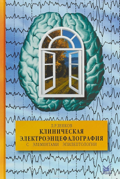 Книга Клиническая электроэнцефалография (с элементами эпилептологии) 9-е изд. на ReadRate.com книга Клиническая электроэнцефалография (с элементами эпилептологии) 9-е изд.