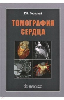 Книга Томография сердца. Руководство для врачей на ReadRate.com книга Томография сердца. Руководство для врачей