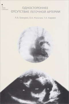 книга Одностороннее отсутствие легочной артерии