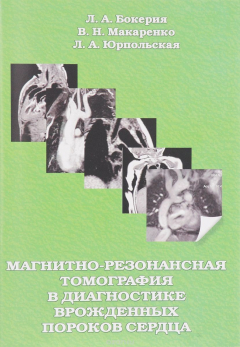 Книга Магнитно-резонансная томография в диагностике врожденных пороков сердца на ReadRate.com книга Магнитно-резонансная томография в диагностике врожденных пороков сердца