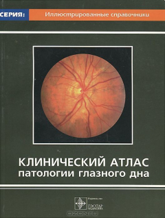 Книга Клинический атлас патологии глазного дна на ReadRate.com книга Клинический атлас патологии глазного дна