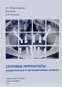 Книга Скуловые имплантаты. Хирургические и ортопедические аспекты на ReadRate.com книга Скуловые имплантаты. Хирургические и ортопедические аспекты