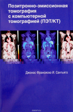 Книга Позитронно-эмиссионная томография с компьютерной томографией на ReadRate.com книга Позитронно-эмиссионная томография с компьютерной томографией