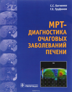 книга МРТ - диагностика очаговых заболеваний печени