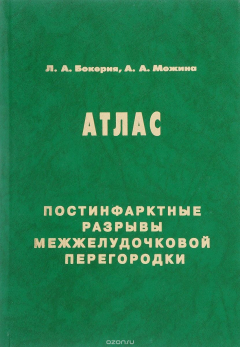 Книга Постинфарктные разрывы межжелудочковой перегородки. Атлас на ReadRate.com книга Постинфарктные разрывы межжелудочковой перегородки. Атлас