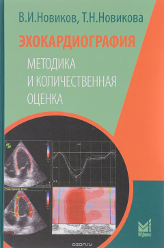 Книга Эхокардиография. Методика и количественная оценка на ReadRate.com книга Эхокардиография. Методика и количественная оценка