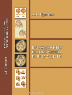 Книга Врожденные пороки черепа и лица у детей на ReadRate.com книга Врожденные пороки черепа и лица у детей