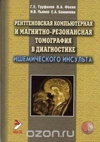 Книга Рентгеновская компьютерная и магнитно-резонансная томография в диагностике ишемического инсульта на ReadRate.com книга Рентгеновская компьютерная и магнитно-резонансная томография в диагностике ишемического инсульта