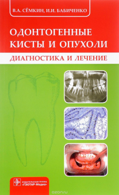 Книга Одонтогенные кисты и опухоли на ReadRate.com книга Одонтогенные кисты и опухоли