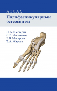 Книга Полифасцикулярный остеосинтез. Атлас на ReadRate.com книга Полифасцикулярный остеосинтез. Атлас