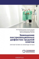 книга Замещение пострезекционных дефектов грудной клетки