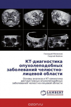 Книга КТ-диагностика опухолеподобных заболеваний челюстно-лицевой области на ReadRate.com книга КТ-диагностика опухолеподобных заболеваний челюстно-лицевой области