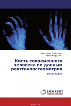 Книга Кисть современного человека по данным рентгеноостеометрии на ReadRate.com книга Кисть современного человека по данным рентгеноостеометрии