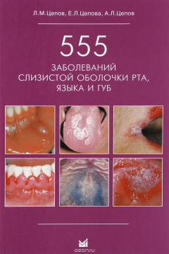 Книга 555 заболеваний слизистой оболочки рта, языка и губ на ReadRate.com книга 555 заболеваний слизистой оболочки рта, языка и губ
