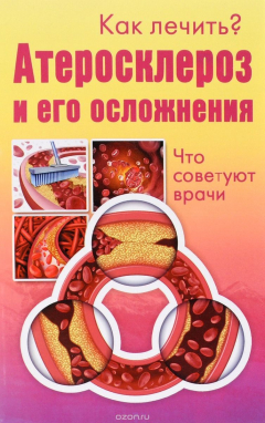 Книга Атеросклероз и его осложнения. Что советуют врачи на ReadRate.com книга Атеросклероз и его осложнения. Что советуют врачи