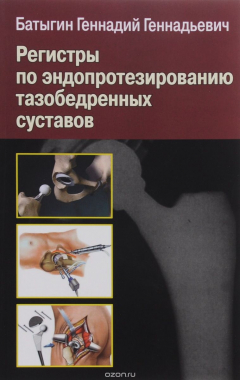 Книга Регистры по эндопротезированию тазобедренных суставов на ReadRate.com книга Регистры по эндопротезированию тазобедренных суставов