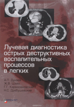 Книга Лучевая диагностика острых деструктивных воспалительных процессов в легких на ReadRate.com книга Лучевая диагностика острых деструктивных воспалительных процессов в легких