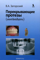 книга Перекрывающие протезы