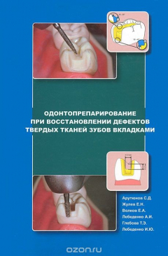 Книга Одонтопрепарирование при восстановлении дефектов твердых тканей зубов вкладками на ReadRate.com книга Одонтопрепарирование при восстановлении дефектов твердых тканей зубов вкладками