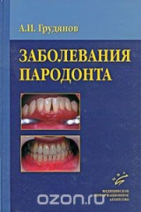 книга Заболевания пародонта