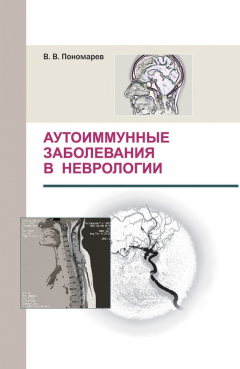 Книга Аутоиммунные заболевания в неврологии на ReadRate.com книга Аутоиммунные заболевания в неврологии