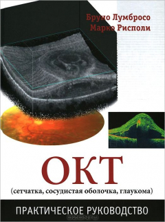 Книга ОКТ. Практическое руководство на ReadRate.com книга ОКТ. Практическое руководство