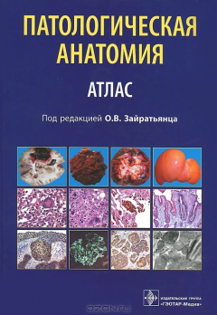 Книга Патологическая анатомия. Атлас. Учебное пособие на ReadRate.com книга Патологическая анатомия. Атлас. Учебное пособие