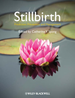 Книга Stillbirth. Prediction, Prevention and Management на ReadRate.com книга Stillbirth. Prediction, Prevention and Management