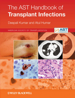 Книга The AST Handbook of Transplant Infections на ReadRate.com книга The AST Handbook of Transplant Infections