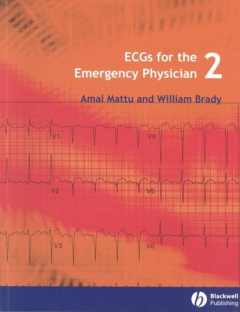 Книга ECGs for the Emergency Physician 2 на ReadRate.com книга ECGs for the Emergency Physician 2