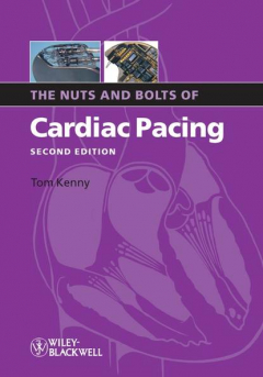 Книга The Nuts and Bolts of Cardiac Pacing на ReadRate.com книга The Nuts and Bolts of Cardiac Pacing