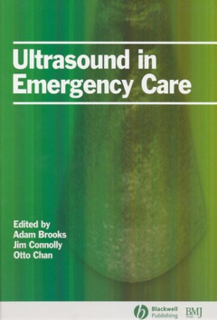 Книга Ultrasound in Emergency Care на ReadRate.com книга Ultrasound in Emergency Care