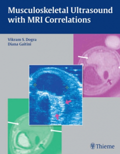 Книга Musculoskeletal Ultrasound with MRI Correlations на ReadRate.com книга Musculoskeletal Ultrasound with MRI Correlations