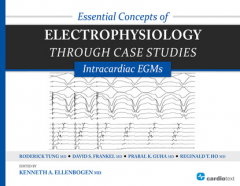 Книга Essential Concepts of Electrophysiology through Case Studies: Intracardiac EGMs на ReadRate.com книга Essential Concepts of Electrophysiology through Case Studies: Intracardiac EGMs