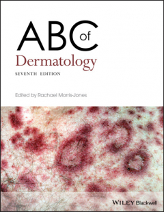 Книга ABC of Dermatology на ReadRate.com книга ABC of Dermatology
