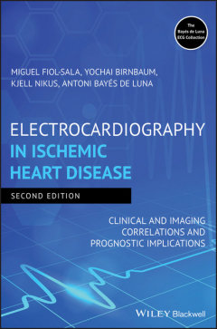 Книга Electrocardiography in Ischemic Heart Disease на ReadRate.com книга Electrocardiography in Ischemic Heart Disease