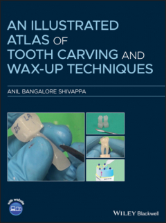 Книга An Illustrated Atlas of Tooth Carving and Wax-Up Techniques на ReadRate.com книга An Illustrated Atlas of Tooth Carving and Wax-Up Techniques