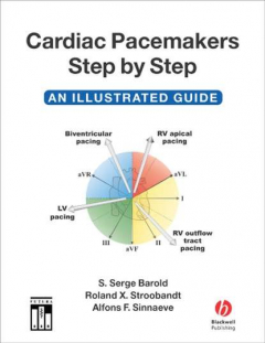 Книга Cardiac Pacemakers Step-by-Step на ReadRate.com книга Cardiac Pacemakers Step-by-Step