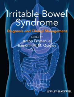 Книга Irritable Bowel Syndrome. Diagnosis and Clinical Management на ReadRate.com книга Irritable Bowel Syndrome. Diagnosis and Clinical Management