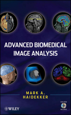 Книга Advanced Biomedical Image Analysis на ReadRate.com книга Advanced Biomedical Image Analysis