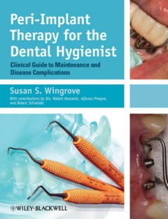 Книга Peri-Implant Therapy for the Dental Hygienist. Clinical Guide to Maintenance and Disease Complications на ReadRate.com книга Peri-Implant Therapy for the Dental Hygienist. Clinical Guide to Maintenance and Disease Complications