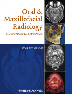 Книга Oral and Maxillofacial Radiology. A Diagnostic Approach на ReadRate.com книга Oral and Maxillofacial Radiology. A Diagnostic Approach