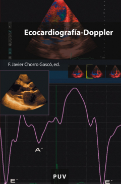 Книга Ecocardiograf?a-Doppler на ReadRate.com книга Ecocardiograf?a-Doppler